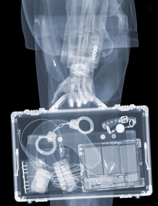This Guy Exposed Himself To X-Ray Radiation For 20 Years