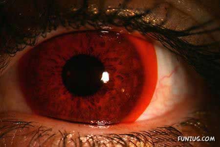 Stylish Fashionable Eye Lenses